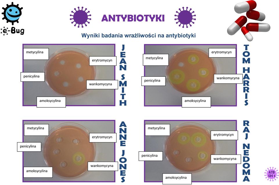 wankomycyna amoksycylina amoksycylina metycylina metycylina penicylina