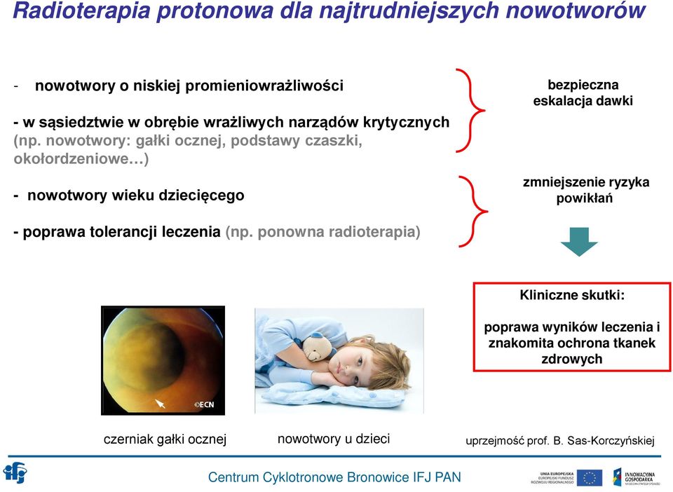 nowotwory: gałki ocznej, podstawy czaszki, okołordzeniowe ) - nowotwory wieku dziecięcego bezpieczna eskalacja dawki zmniejszenie