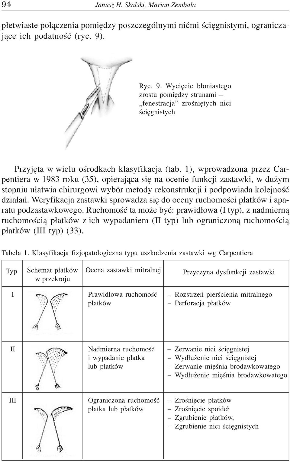 1), wprowadzona przez Carpentiera w 1983 roku (35), opieraj¹ca siê na ocenie funkcji zastawki, w du ym stopniu u³atwia chirurgowi wybór metody rekonstrukcji i podpowiada kolejnoœæ dzia³añ.