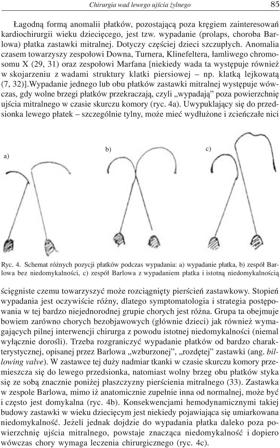 Anomalia czasem towarzyszy zespo³owi Downa, Turnera, Klinefeltera, ³amliwego chromosomu X (29, 31) oraz zespo³owi Marfana [niekiedy wada ta wystêpuje równie w skojarzeniu z wadami struktury klatki