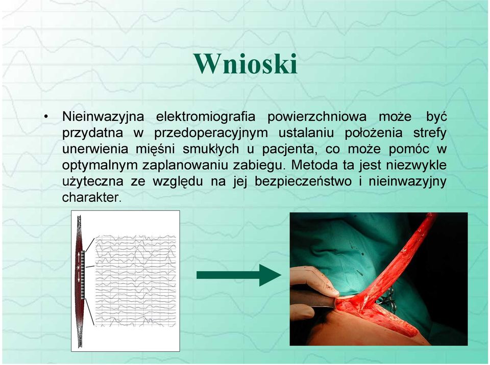 pacjenta, co może pomóc w optymalnym zaplanowaniu zabiegu.