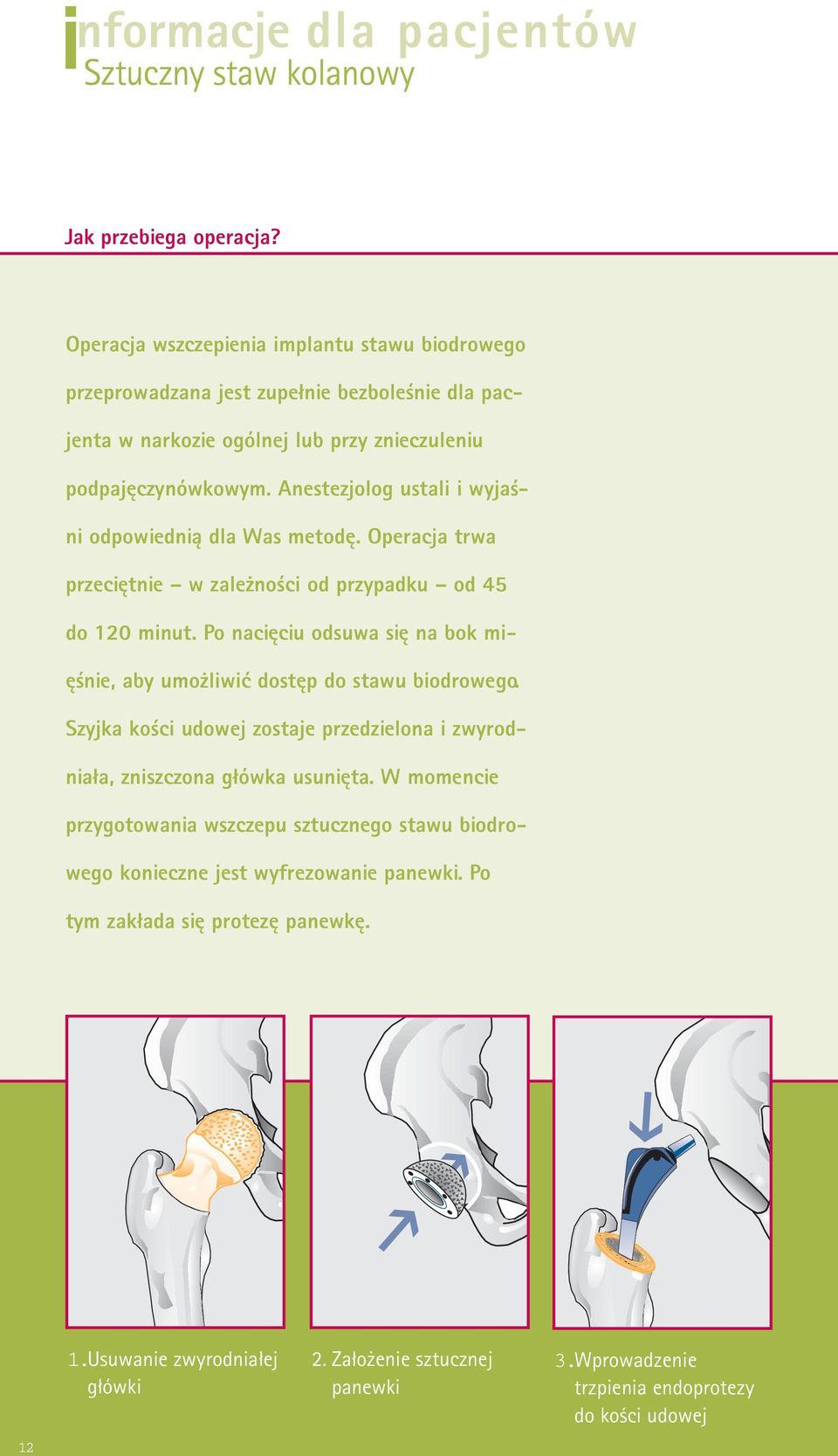 Anestezjolog ustali i wyjaśni odpowiednią dla Was metodę. Operacja trwa przeciętnie w zależności od przypadku od 45 do 120 minut.