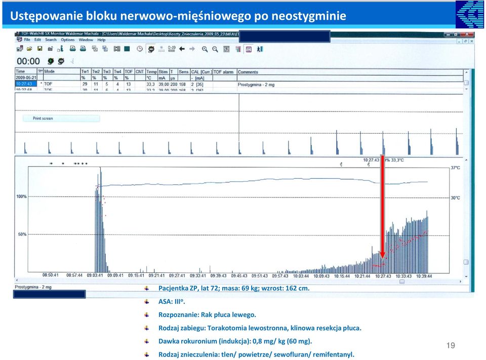 Rodzaj zabiegu: Torakotomia lewostronna, klinowa resekcja płuca.