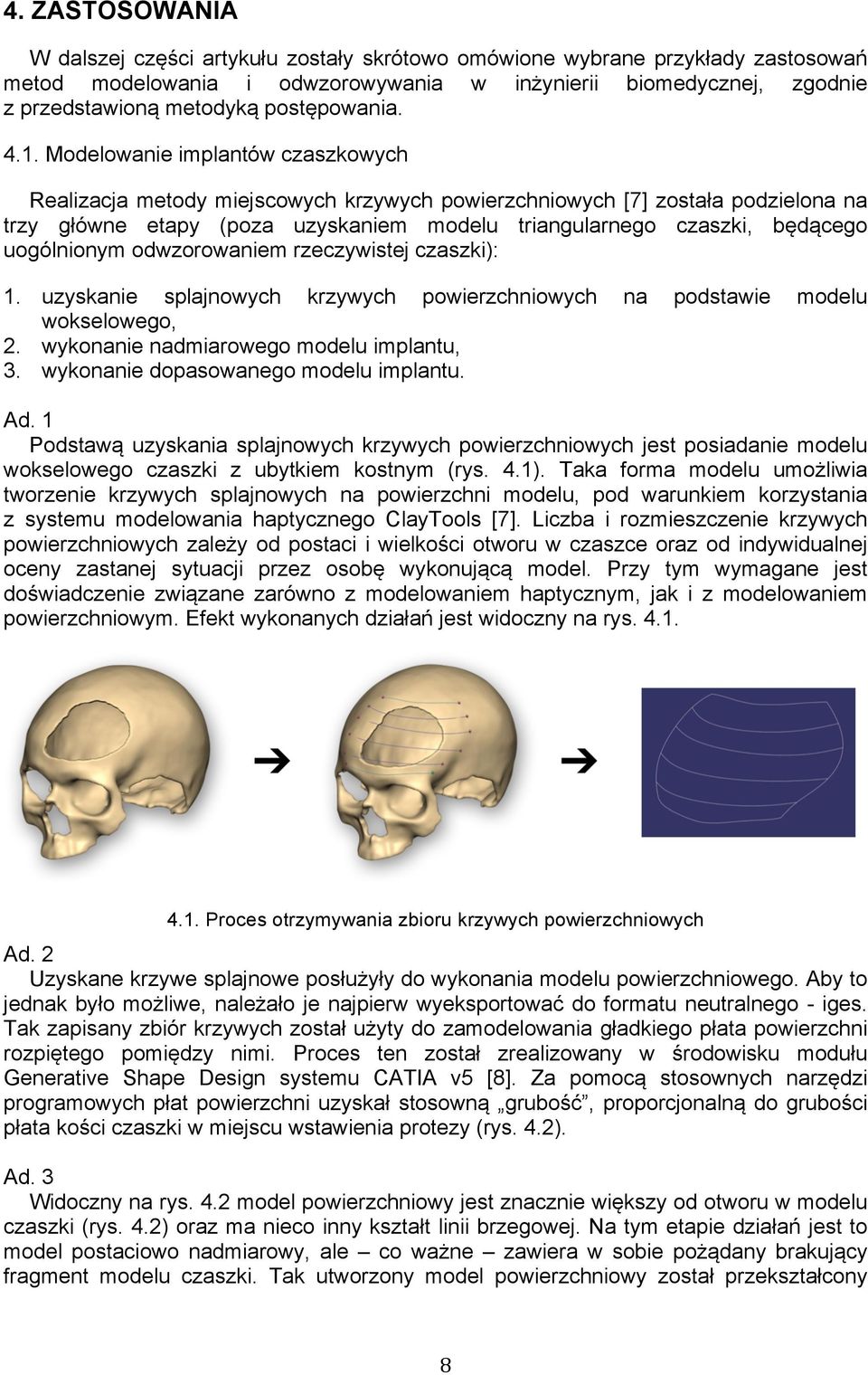 Modelowanie implantów czaszkowych Realizacja metody miejscowych krzywych powierzchniowych [7] została podzielona na trzy główne etapy (poza uzyskaniem modelu triangularnego czaszki, będącego