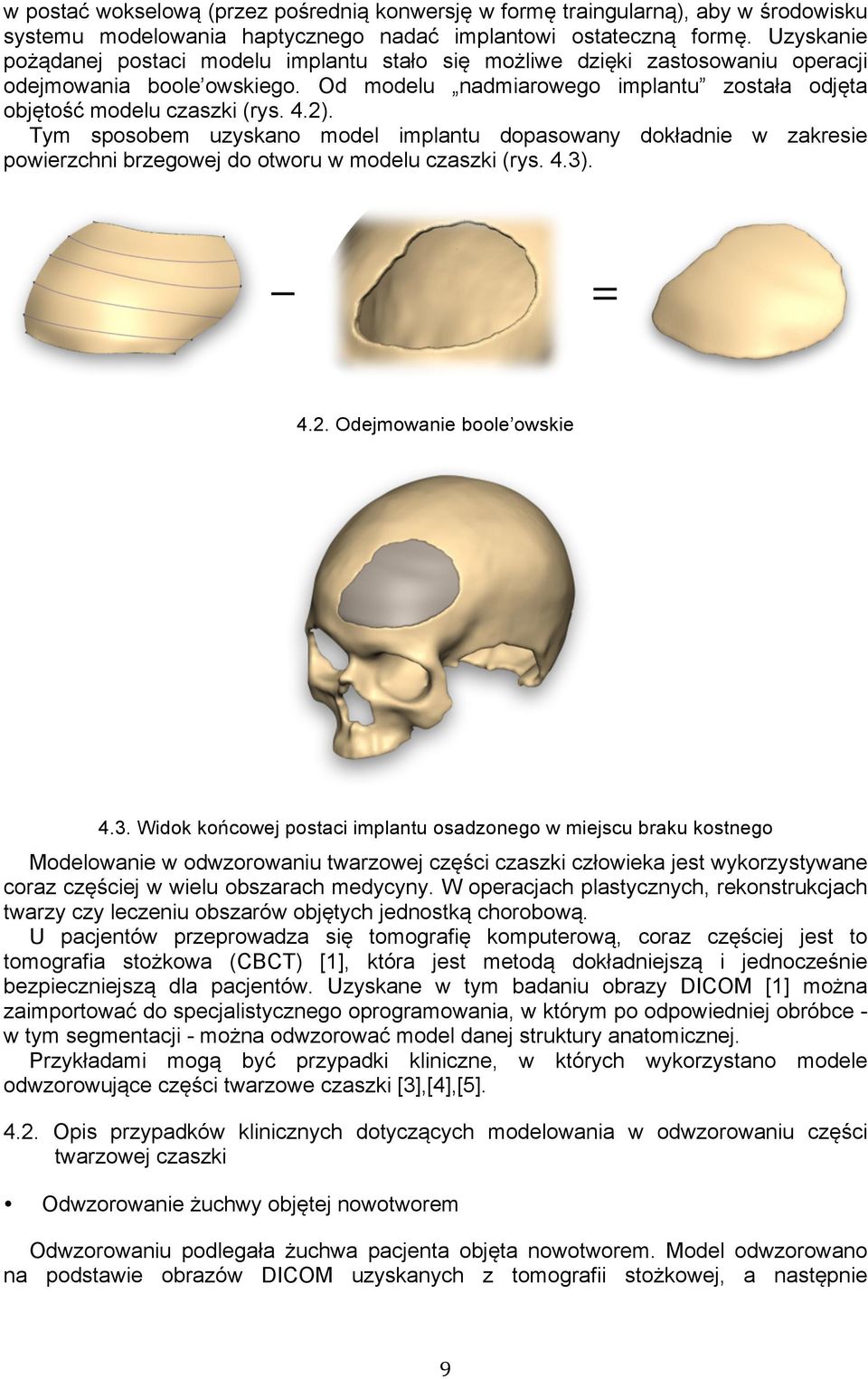 2). Tym sposobem uzyskano model implantu dopasowany dokładnie w zakresie powierzchni brzegowej do otworu w modelu czaszki (rys. 4.3)