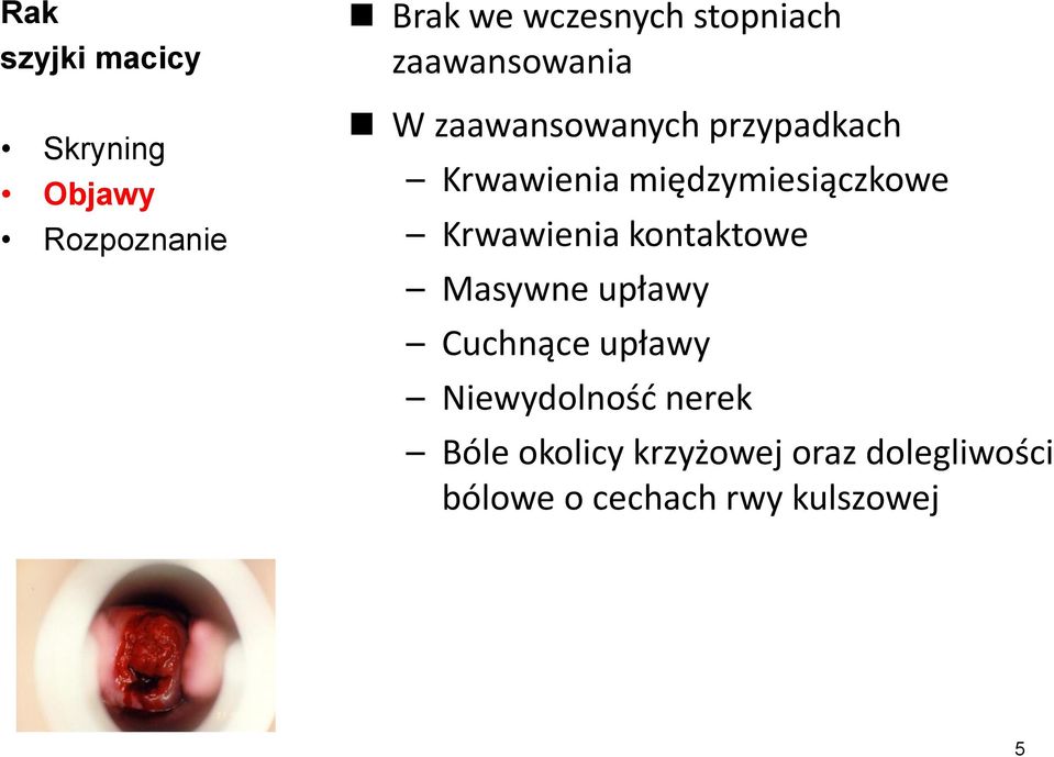 Krwawienia kontaktowe Masywne upławy Cuchnące upławy