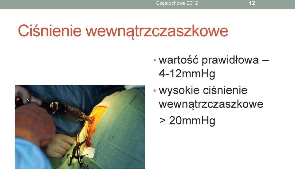 prawidłowa 4-12mmHg wysokie