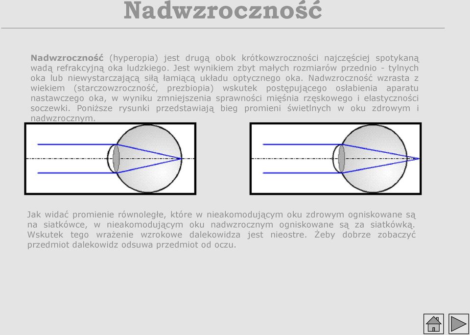 Nadwzroczność wzrasta z wiekiem (starczowzroczność, prezbiopia) wskutek postępującego osłabienia aparatu nastawczego oka, w wyniku zmniejszenia sprawności mięśnia rzęskowego i elastyczności soczewki.