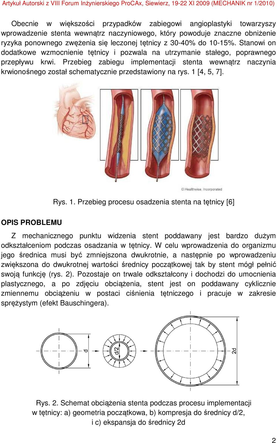 Przebieg zabiegu implementacji stenta wewnątrz naczynia krwionośnego został schematycznie przedstawiony na rys. 1 