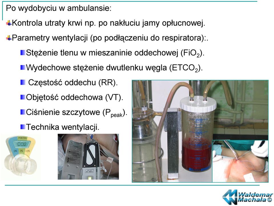 Stężenie tlenu w mieszaninie oddechowej (FiO2).