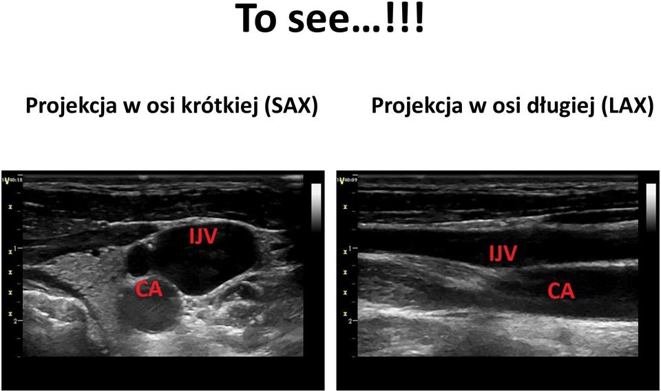 osi krótkiej