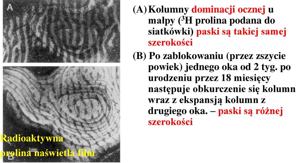 tyg. po urodzeniu przez 18 miesięcy następuje obkurczenie się kolumn wraz z