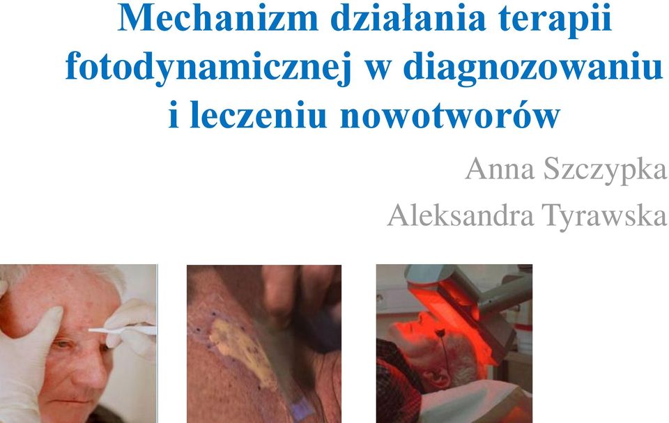 diagnozowaniu i leczeniu