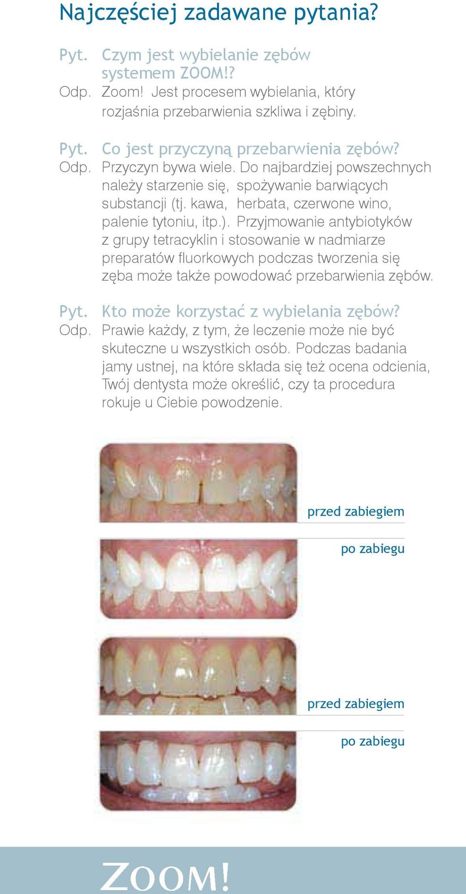 Przyjmowanie antybiotyków z grupy tetracyklin i stosowanie w nadmiarze preparatów fluorkowych podczas tworzenia się zęba może także powodować przebarwienia zębów. Pyt.