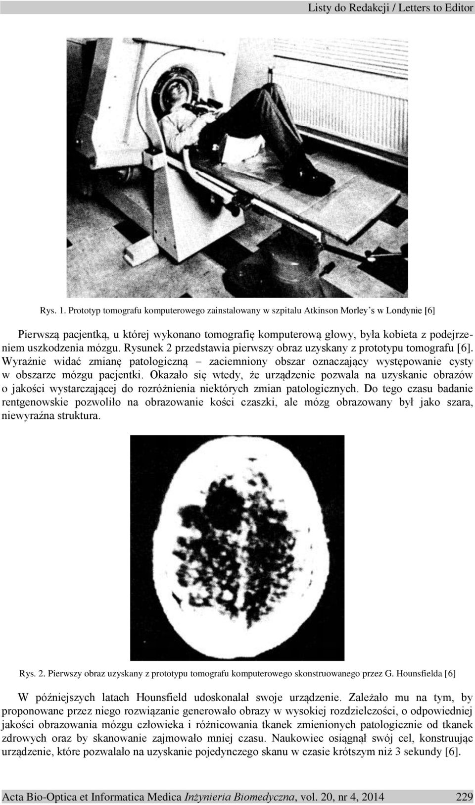 mózgu. Rysunek 2 przedstawia pierwszy obraz uzyskany z prototypu tomografu [6]. Wyraźnie widać zmianę patologiczną zaciemniony obszar oznaczający występowanie cysty w obszarze mózgu pacjentki.