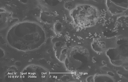 domieszkowanie lakierów Proszkowe materiały tlenkowe o właściwościach magnetycznych 10 8 6 4 2 Klebsiella pneumoniae normalny SiO 2 0.