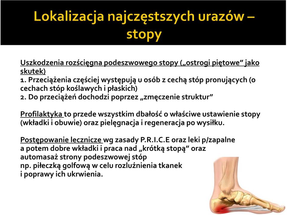 Do przeciążeń dochodzi poprzez zmęczenie struktur Profilaktyka to przede wszystkim dbałość o właściwe ustawienie stopy (wkładki i obuwie) oraz