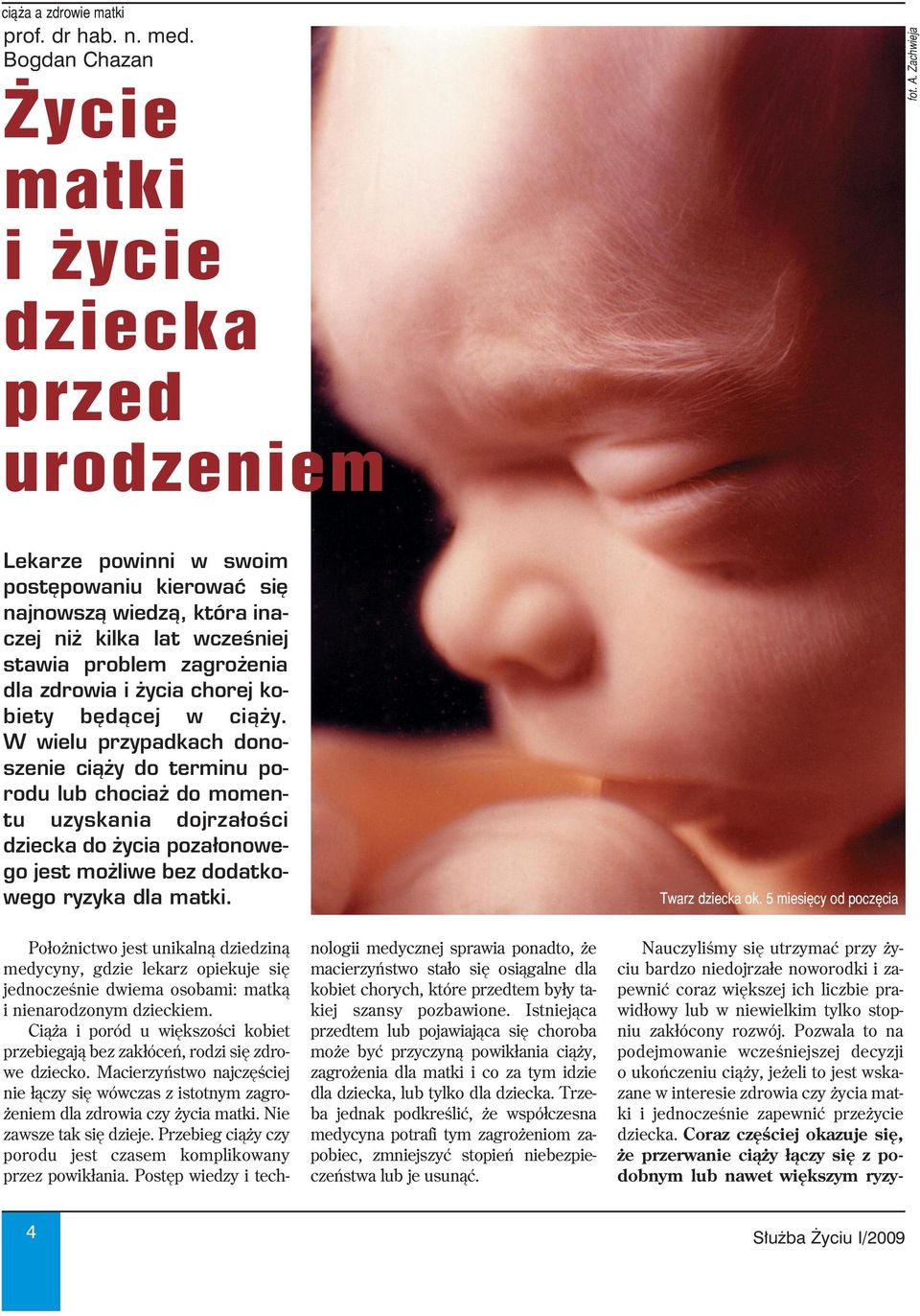 W wielu przypadkach dono szenie ciąży do terminu po rodu lub chociaż do momen tu uzyskania dojrzałości dziecka do życia pozałonowe go jest możliwe bez dodatko wego ryzyka dla matki. Twarz dziecka ok.