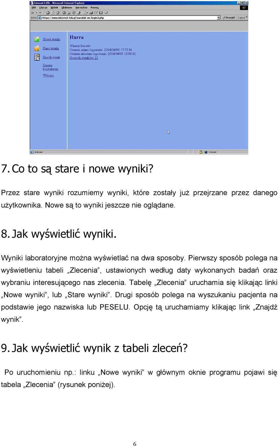 Pierwszy sposób polega na wyświetleniu tabeli Zlecenia, ustawionych według daty wykonanych badań oraz wybraniu interesującego nas zlecenia.