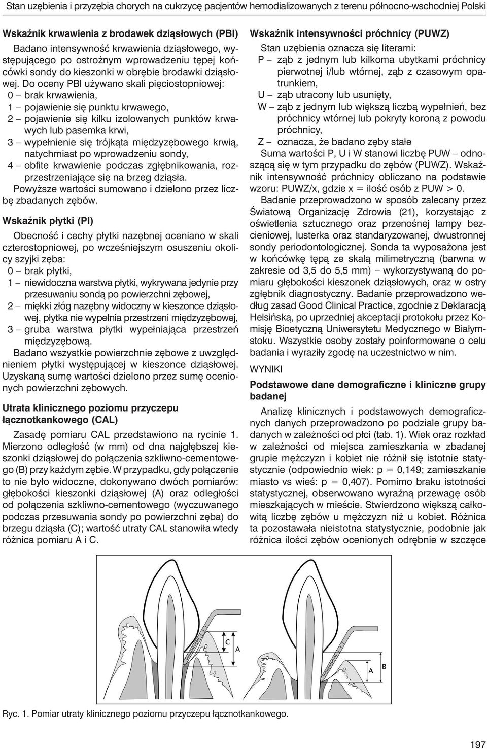 Do oceny PBI używano skali pięciostopniowej: 0 brak krwawienia, 1 pojawienie się punktu krwawego, 2 pojawienie się kilku izolowanych punktów krwawych lub pasemka krwi, 3 wypełnienie się trójkąta