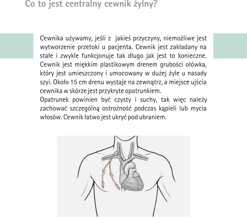 Cewnik jest miêkkim plastikowym drenem gruboœci o³ówka, który jest umieszczony i umocowany w du ej yle u nasady szyi.