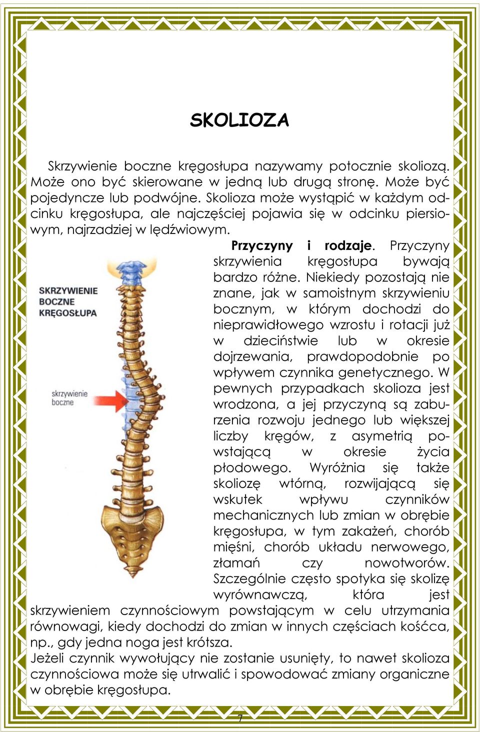 Przyczyny skrzywienia kręgosłupa bywają bardzo różne.