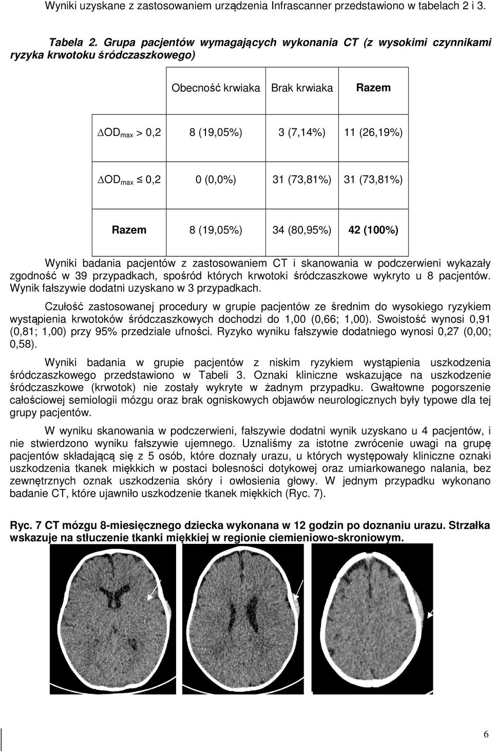 31 (73,81%) 31 (73,81%) Razem 8 (19,05%) 34 (80,95%) 42 (100%) Wyniki badania pacjentów z zastosowaniem CT i skanowania w podczerwieni wykazały zgodność w 39 przypadkach, spośród których krwotoki