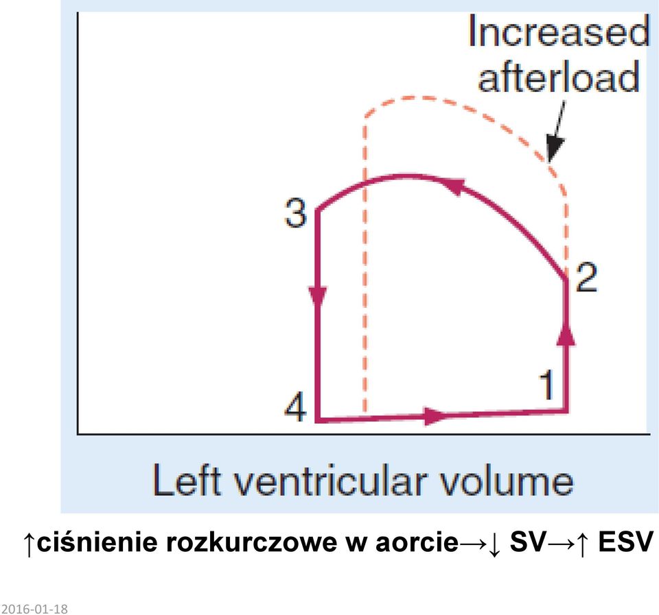 w aorcie SV