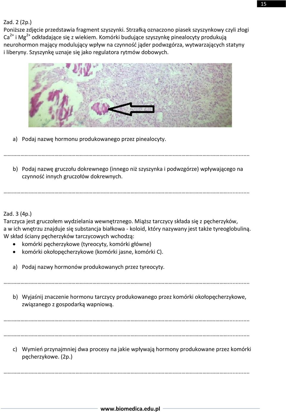 Szyszynkę uznaje się jako regulatora rytmów dobowych. a) Podaj nazwę hormonu produkowanego przez pinealocyty.