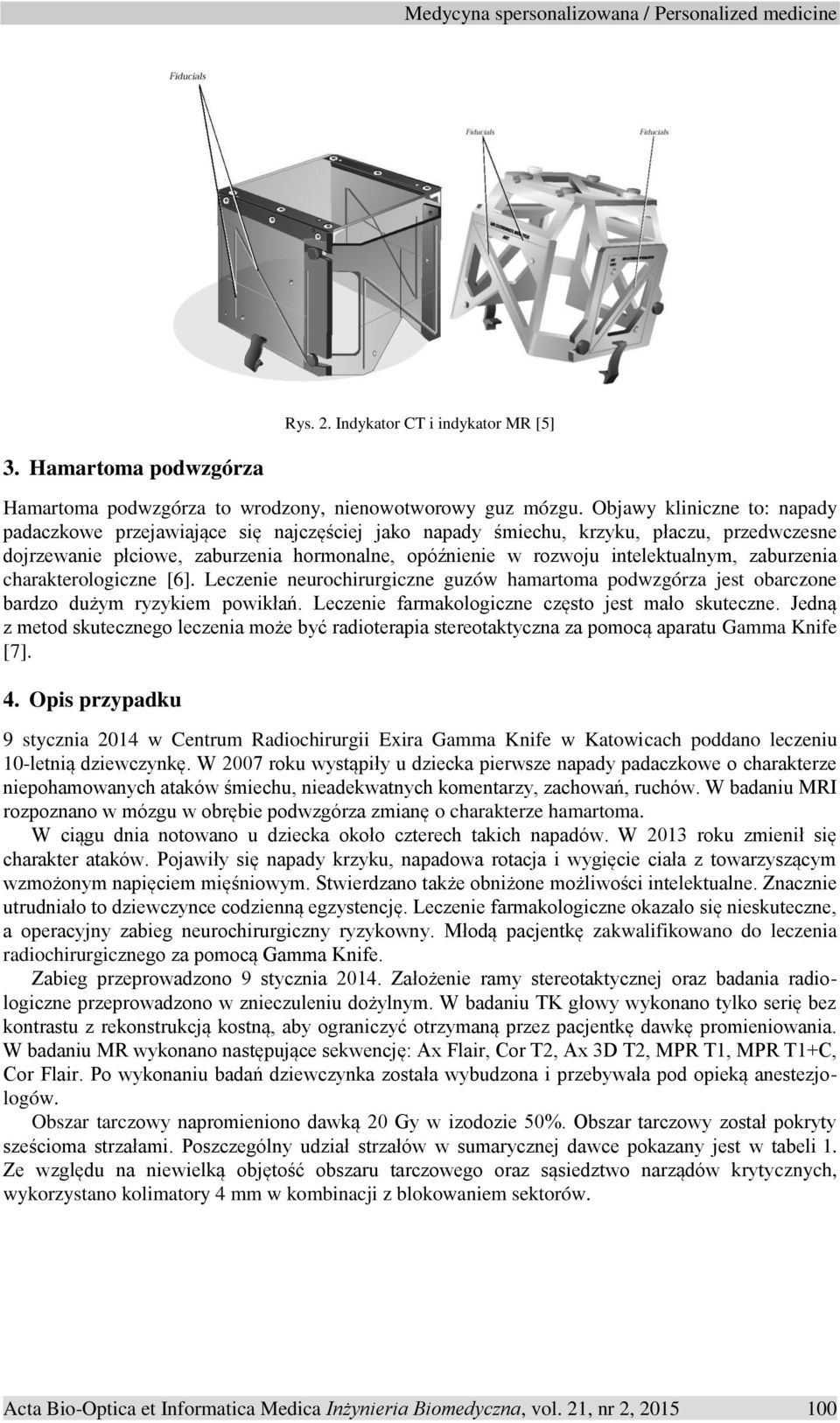 zaburzenia charakterologiczne [6]. Leczenie neurochirurgiczne guzów hamartoma podwzgórza jest obarczone bardzo dużym ryzykiem powikłań. Leczenie farmakologiczne często jest mało skuteczne.