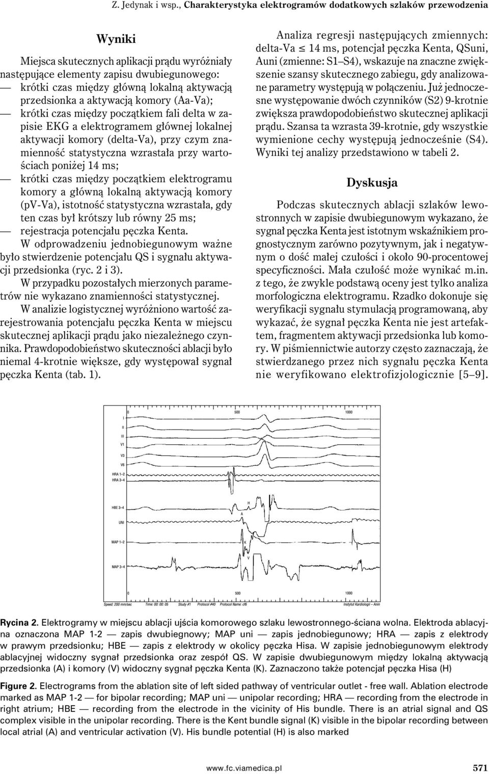 aktywacją przedsionka a aktywacją komory (Aa-Va); krótki czas między początkiem fali delta w zapisie EKG a elektrogramem głównej lokalnej aktywacji komory (delta-va), przy czym znamienność