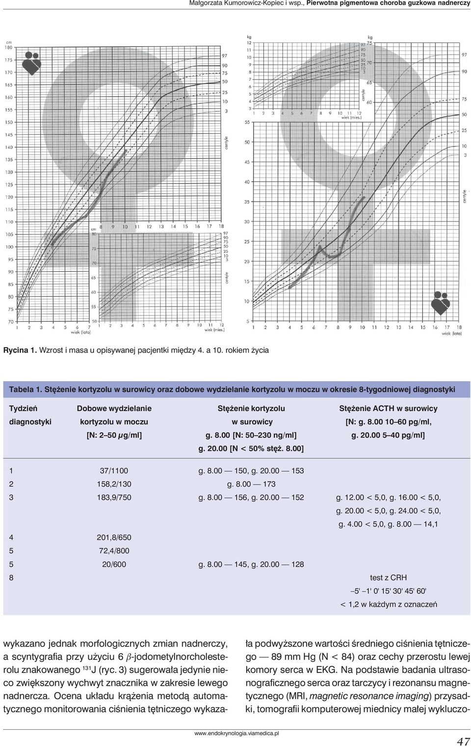 kortyzolu w moczu w surowicy [N: g. 8.00 10 60 pg/ml, [N: 2 50 µg/ml] g. 8.00 [N: 50 230 ng/ml] g. 20.00 5 40 pg/ml] g. 20.00 [N < 50% stęż. 8.00] 1 37/1100 g. 8.00 150, g. 20.00 153 2 158,2/130 g. 8.00 173 3 183,9/750 g.