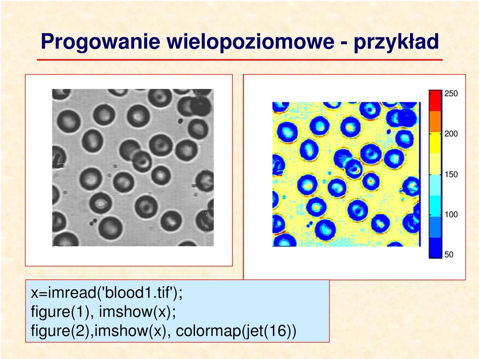 x=imread('blood1.