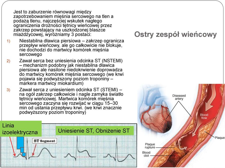 sercowego 2) Zawał serca bez uniesienia odcinka ST (NSTEMI) mechanizm podobny jak niestabilna dławica piersiowa ale nasilone niedokrwienie doprowadza do martwicy komórek mięśnia sercowego (we krwi