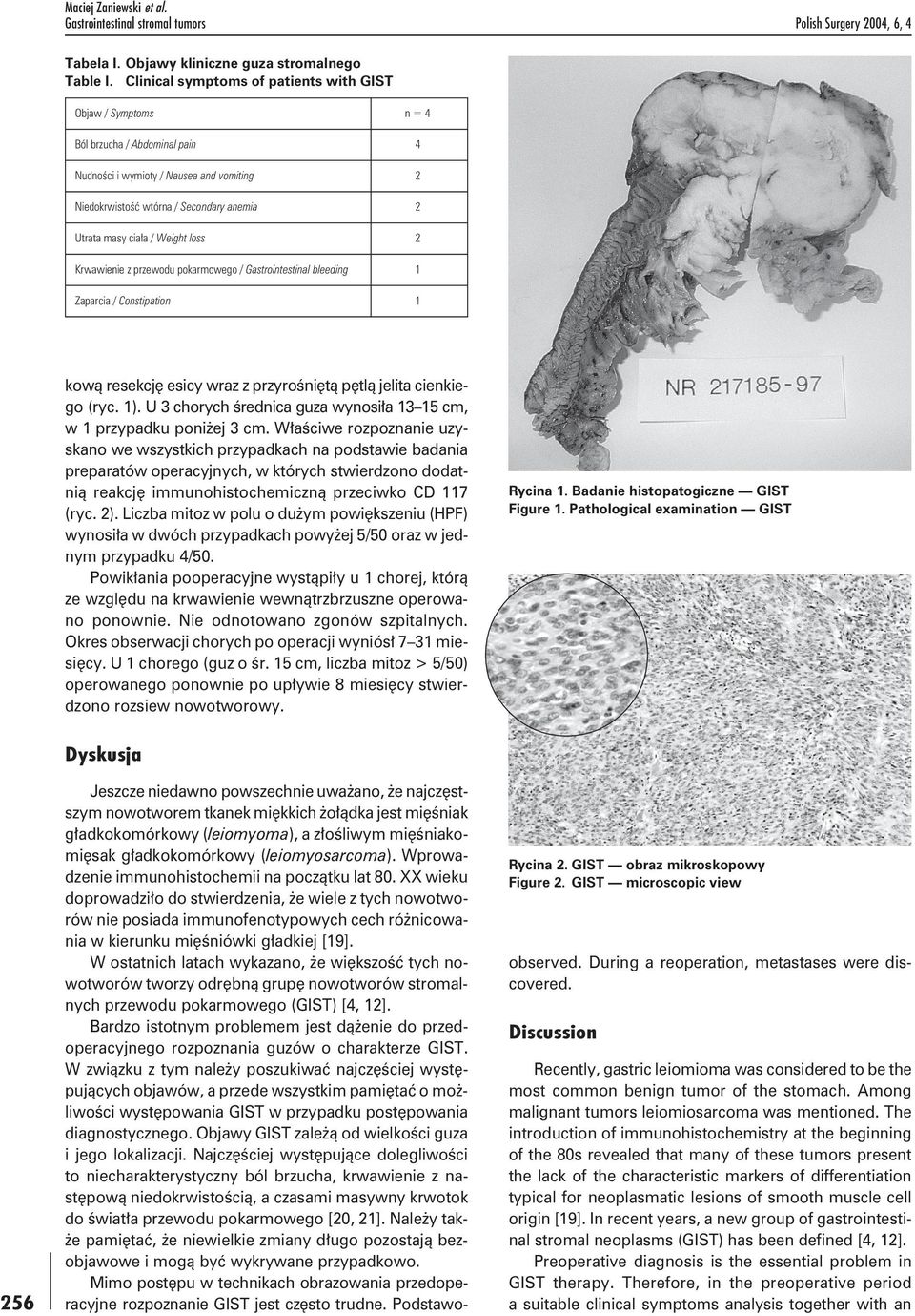 Weight loss 2 Krwawienie z przewodu pokarmowego / Gastrointestinal bleeding 1 Zaparcia / Constipation 1 kową resekcję esicy wraz z przyrośniętą pętlą jelita cienkiego (ryc. 1).