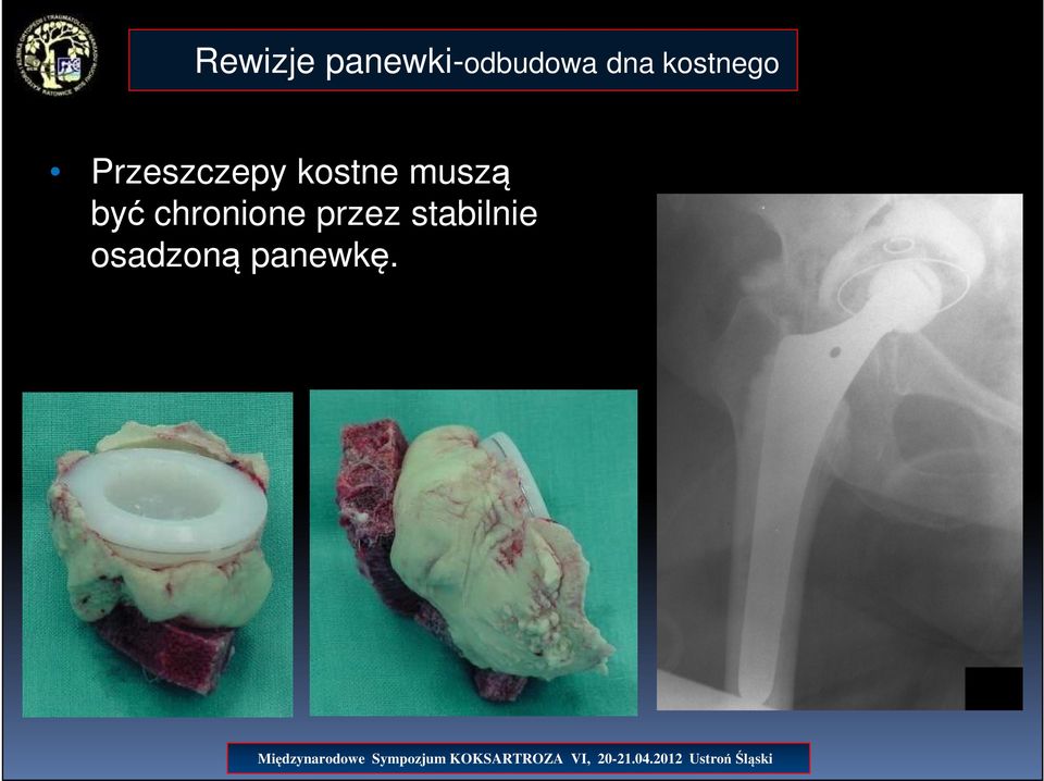 kostne muszą być chronione