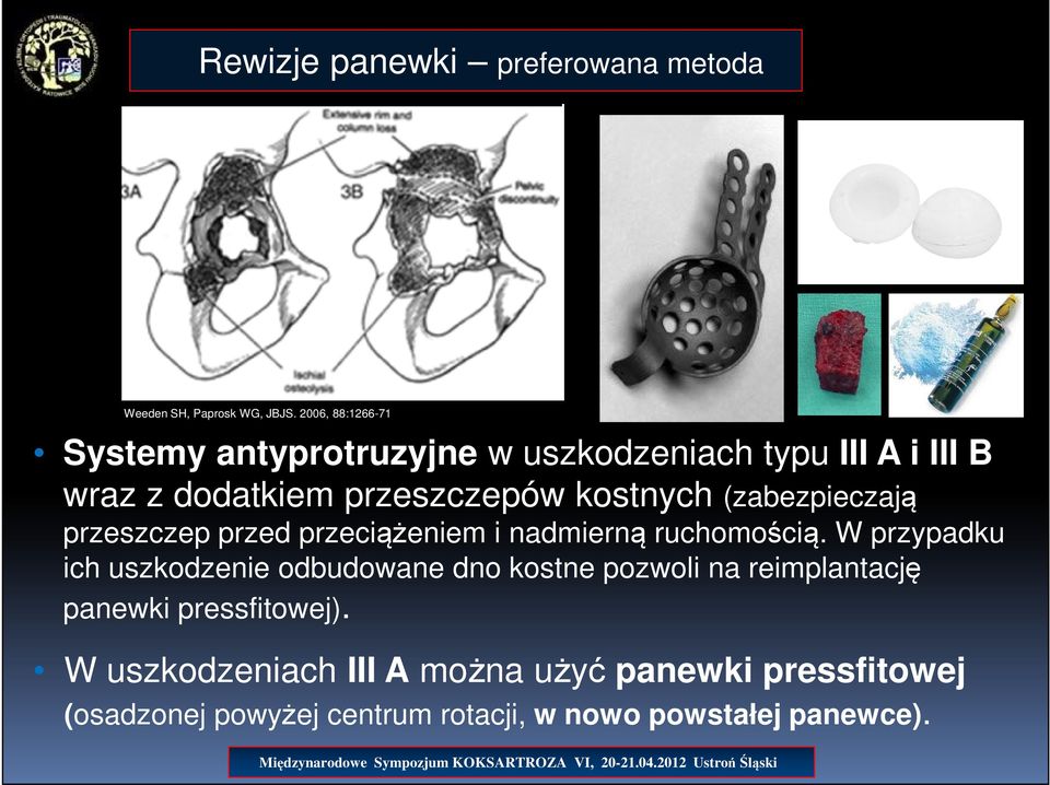 (zabezpieczają przeszczep przed przeciążeniem i nadmierną ruchomością.