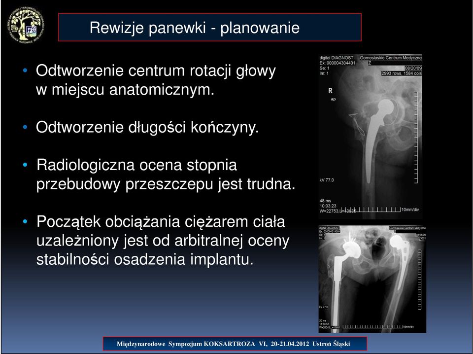 Radiologiczna ocena stopnia przebudowy przeszczepu jest trudna.