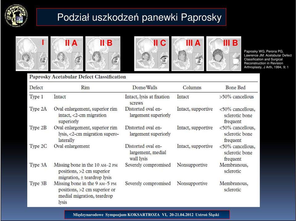 Acetabular Defect Classification and Surgical