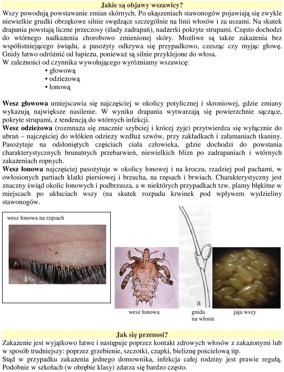 MoŜliwe są takŝe zakaŝenia bez współistniejącego świądu, a pasoŝyty odkrywa się przypadkowo, czesząc czy myjąc głowę. Gnidy łatwo odróŝnić od łupieŝu, poniewaŝ są silnie przyklejone do włosa.