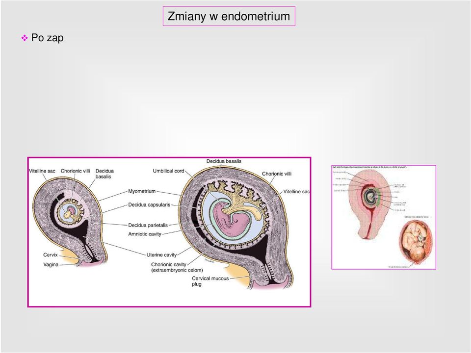 Zmienione endometrium doczesna, a komórki zrębu komórki doczesnowe.
