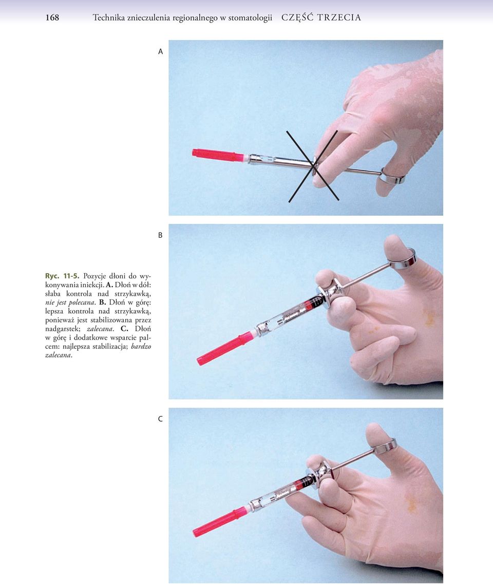 Dłoń w dół: słaba kontrola nad strzykawką, nie jest polecana. B.