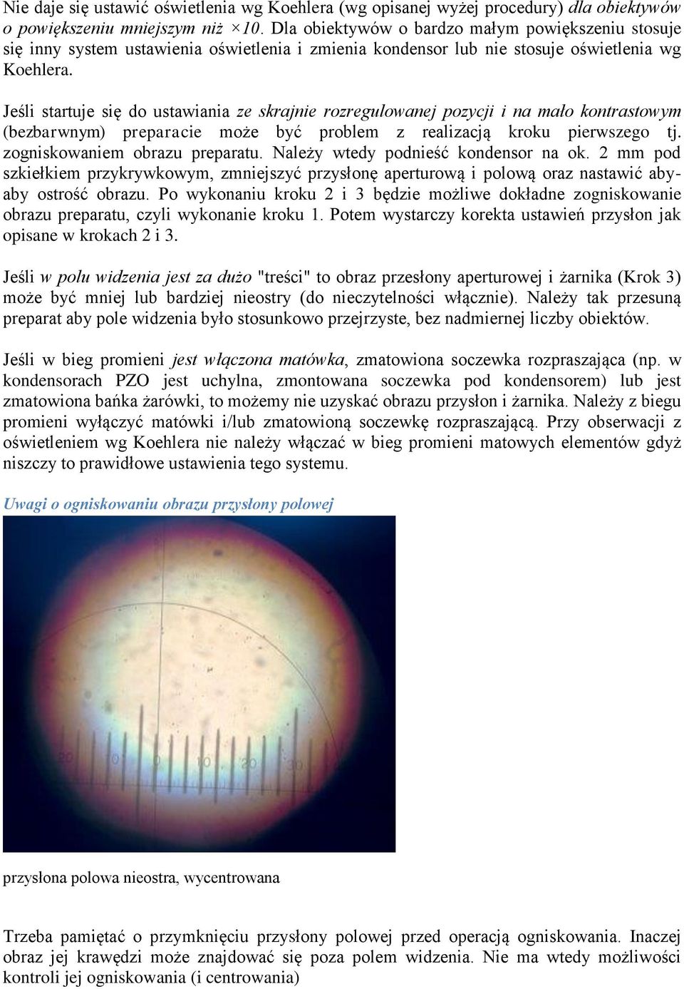 Jeśli startuje się do ustawiania ze skrajnie rozregulowanej pozycji i na mało kontrastowym (bezbarwnym) preparacie może być problem z realizacją kroku pierwszego tj. zogniskowaniem obrazu preparatu.
