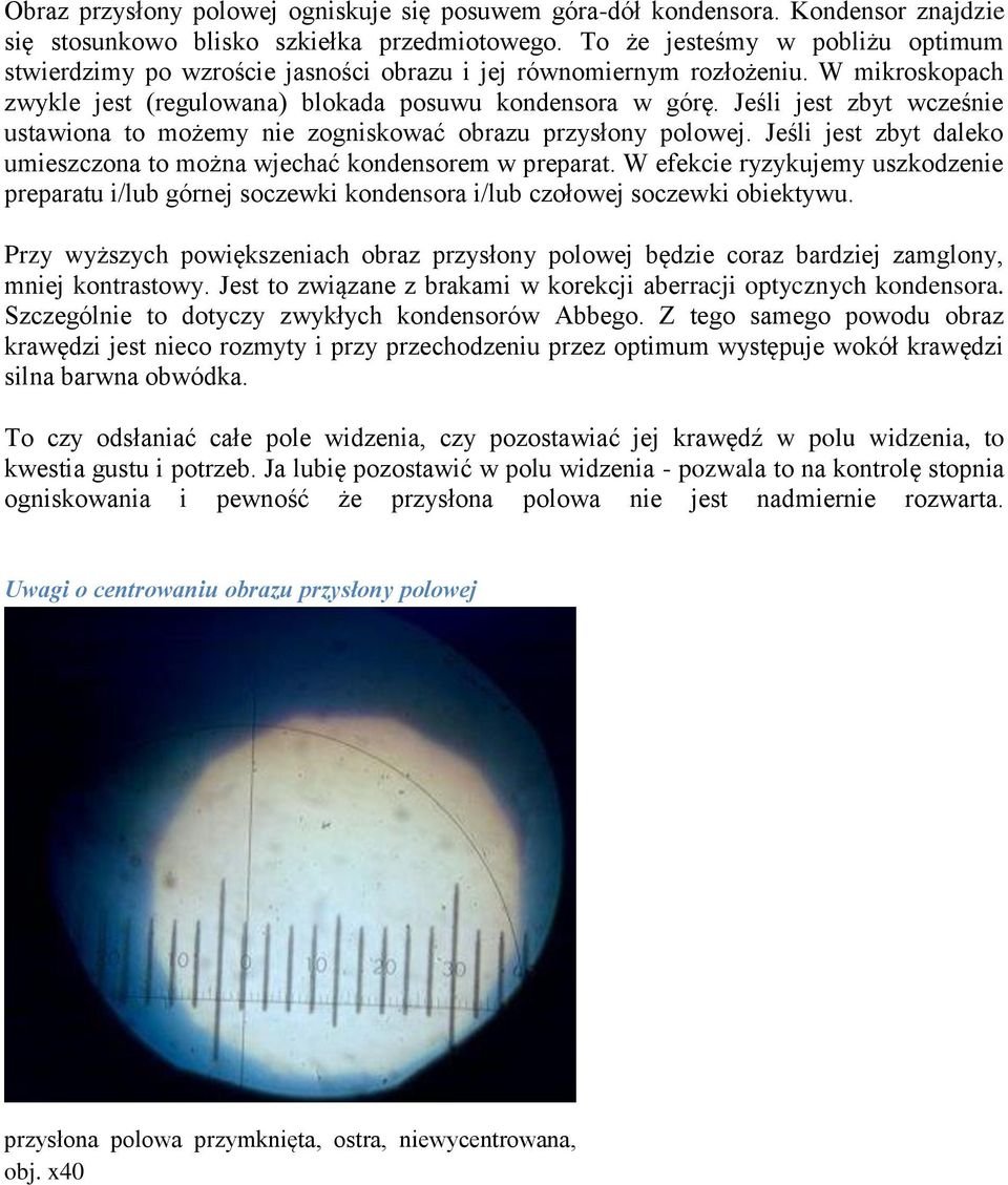 Jeśli jest zbyt wcześnie ustawiona to możemy nie zogniskować obrazu przysłony polowej. Jeśli jest zbyt daleko umieszczona to można wjechać kondensorem w preparat.