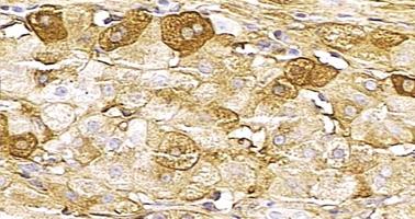 Funkcje wątroby Unieczynnianie hormonów steroidowych Regeneracja komórki owalne (macierzyste), obecne w pobliżu końcowych odcinków kanalików
