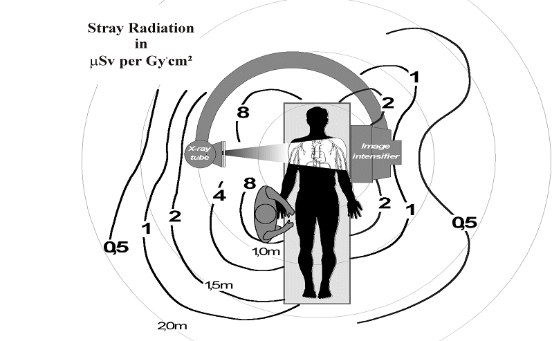 Podstawy ochrony radiologicznej w radiologii
