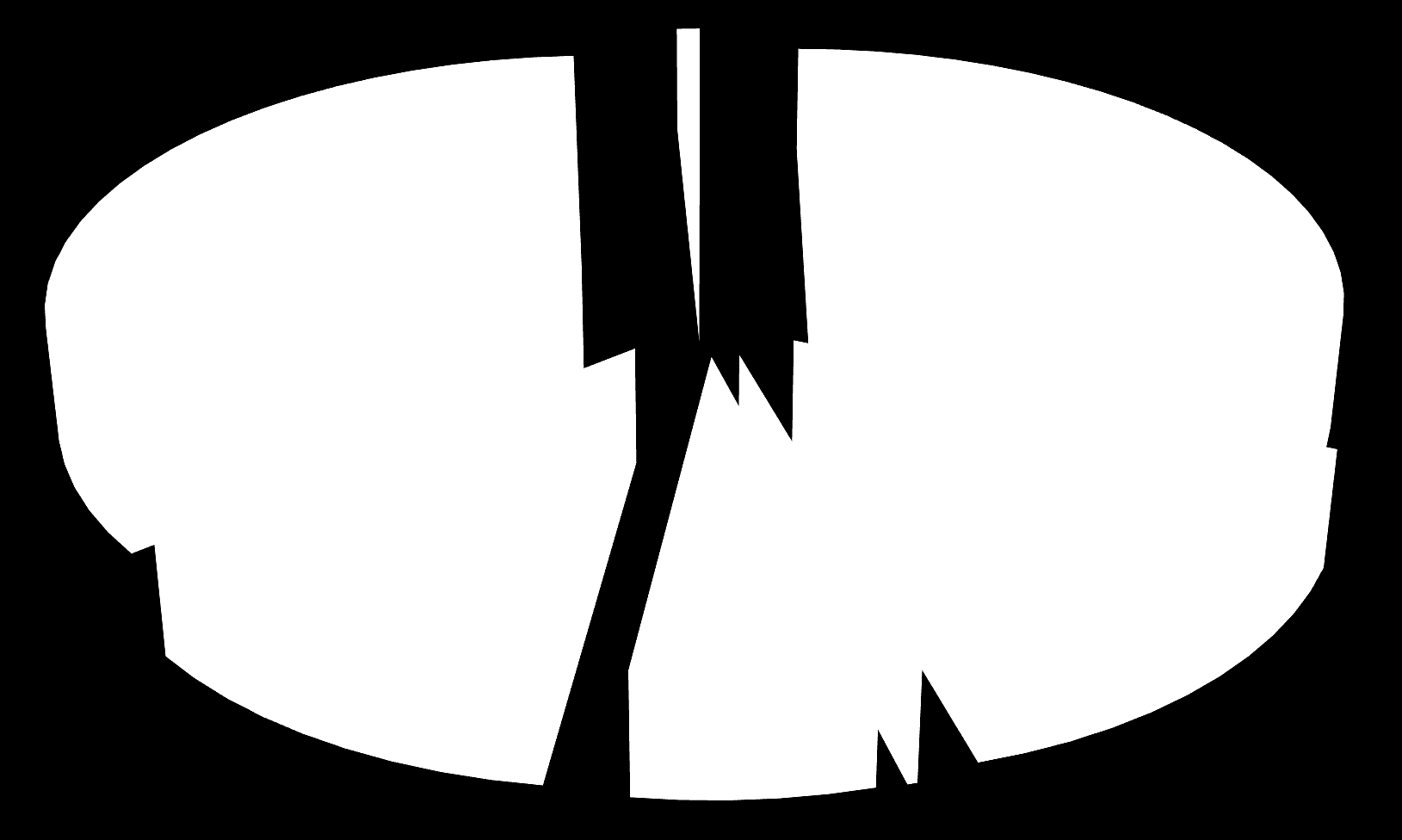 20/2011 1% 0% 35%