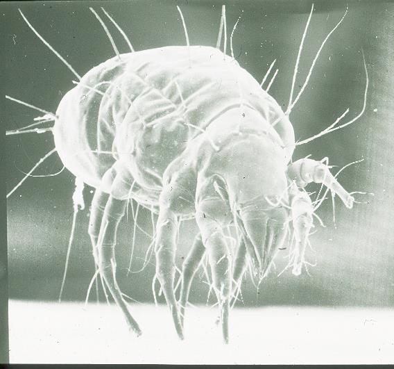 Produkcja mikotoksyn Spots were collected and analysed by electron microscopy: Tyrophagus casei (Cheese mite) HPLC-analysis revealed high levels of ochratoxin A: Ochratoxin A 8.