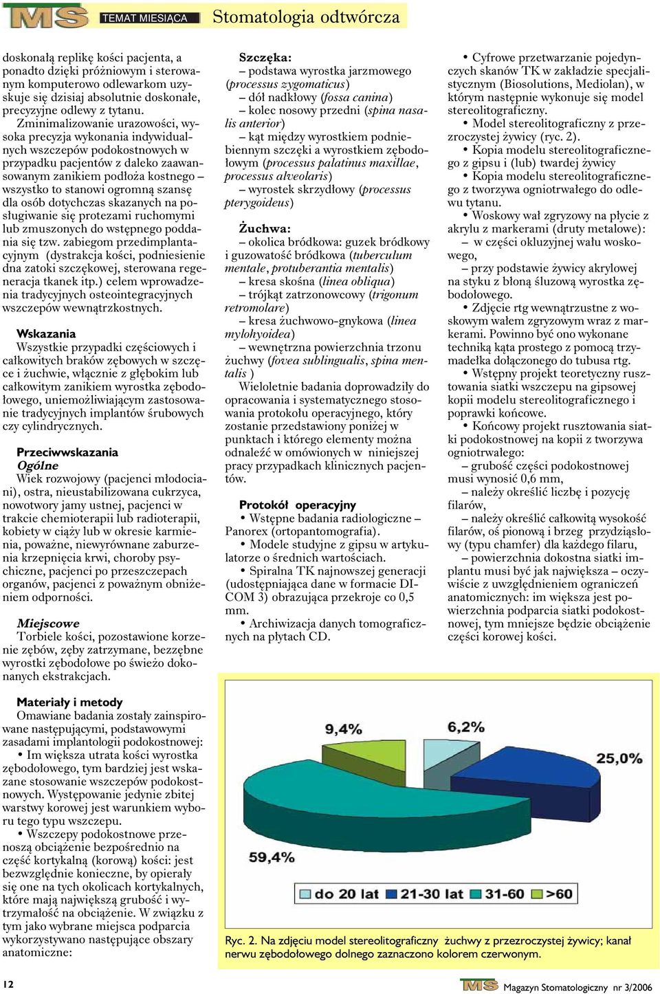 pos³ugiwnie siê protezmi ruhomymi lu zmuszonyh do wstêpnego poddni siê tzw. ziegom przedimplntyjnym (dystrkj koœi, podniesienie dn ztoki szzêkowej, sterown regenerj tknek itp.