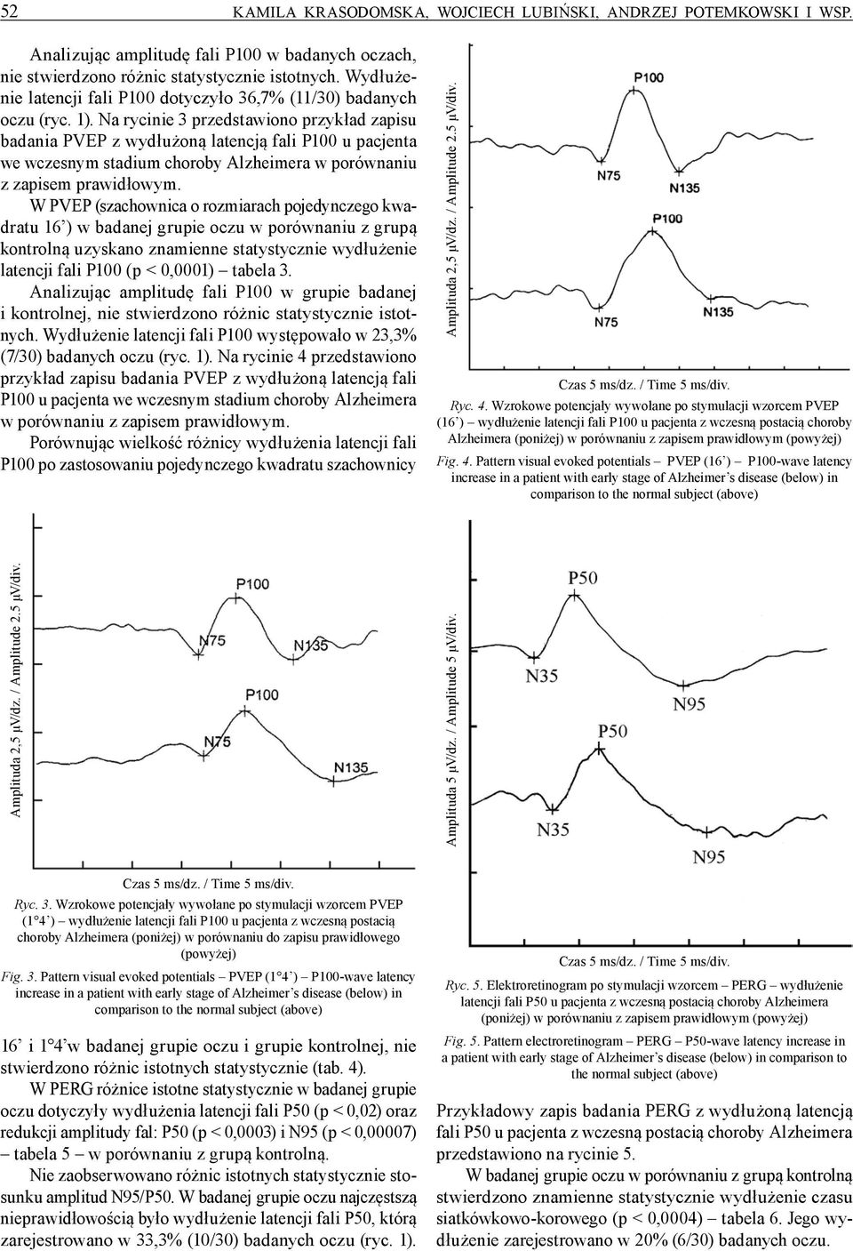 Na rycinie 3 przedstawiono przykład zapisu badania PVEP z wydłużoną latencją fali P100 u pacjenta we wczesnym stadium choroby Alzheimera w porównaniu z zapisem prawidłowym.